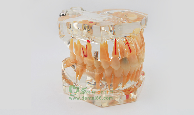 TM-C16-01 Pathology Model